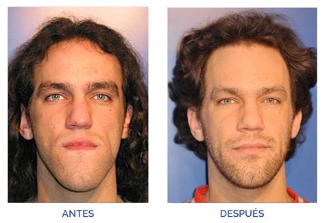 icomf|ICOMF Cirugía Oral y Maxilofacial – Especialistas en Cirugía .